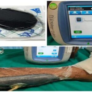 اسفنجة شفط جراحي 12*30 - Vac Negative Pressure Dressing