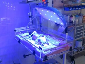 لمبة علاج الصفراء للاطفال